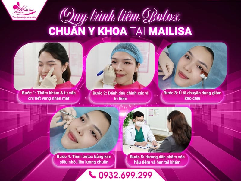 sung-do-sau-tiem-botox-mat-co-binh-thuong-khong