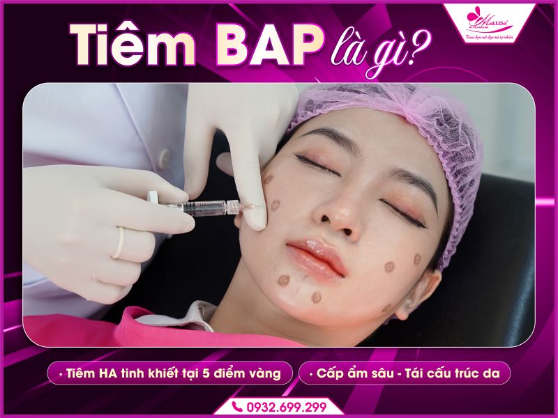 tiem-bap-la-gi