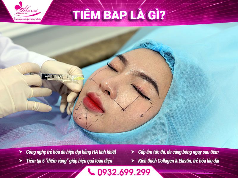 tiem-bap-la-gi
