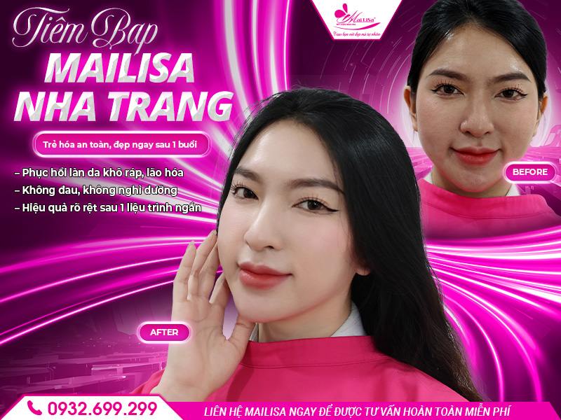 tiem-bap-mailisa-nha-trang-tre-hoa-an-toan
