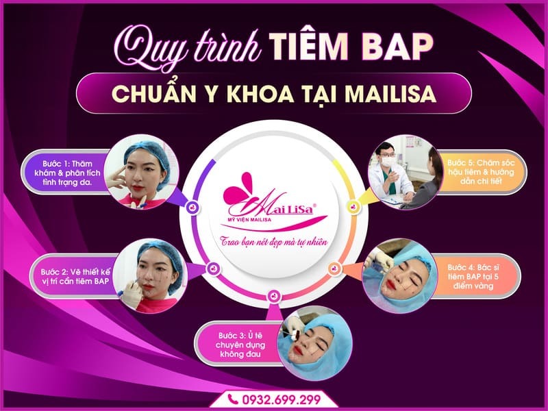tiem-bap-mailisa-vinh