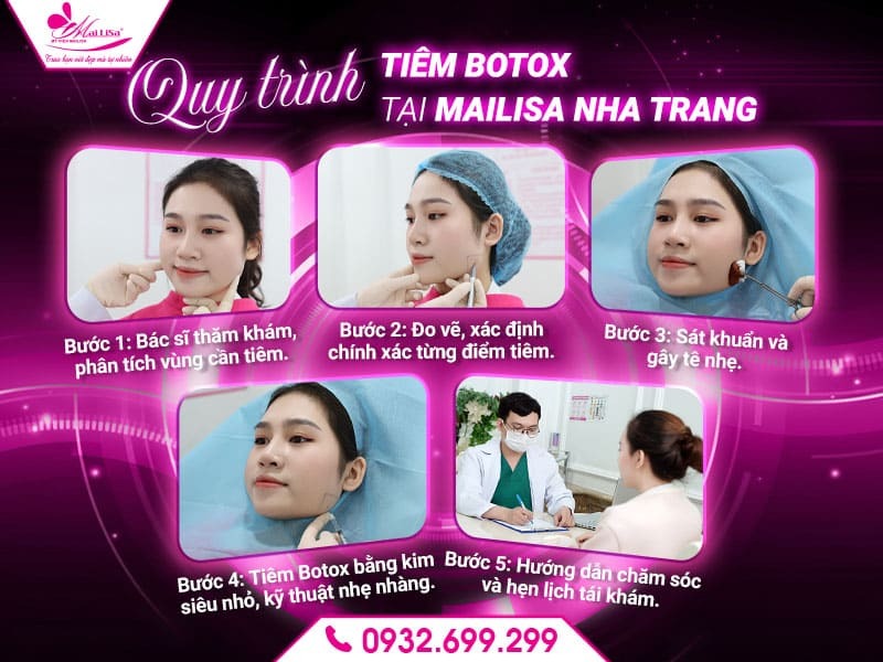 tiem-botox-mailisa-nha-trang