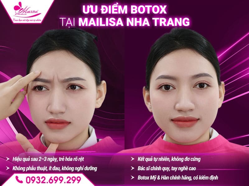 tiem-botox-mailisa-nha-trang