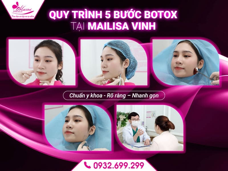 https://mailisa.com tiem-botox-mailisa-vinh