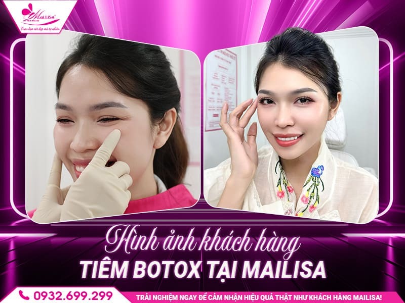 tiem-botox-mat-co-bien-chung-khong