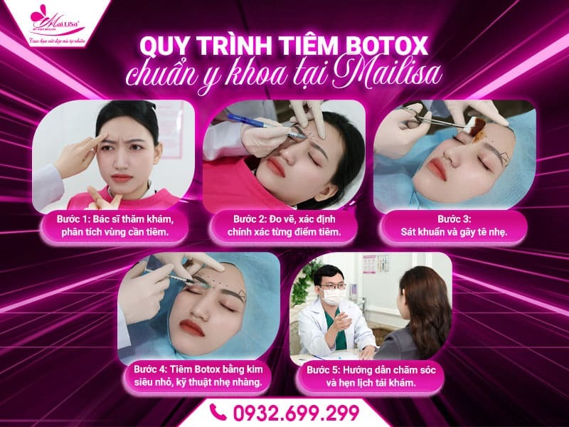 tiem-botox-vung-may-co-dau-khong