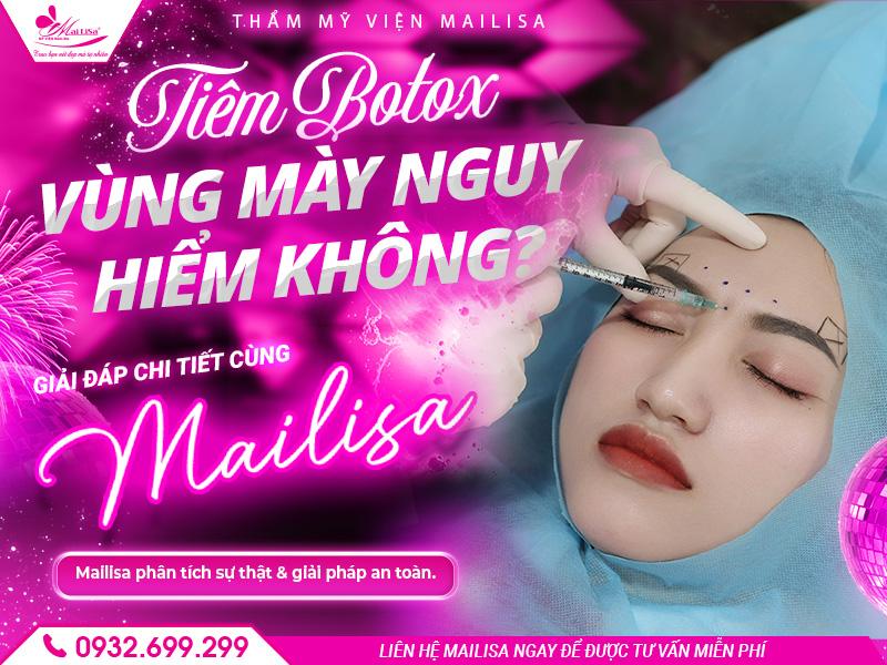 tiem-botox-vung-may-nguy-hiem-khong