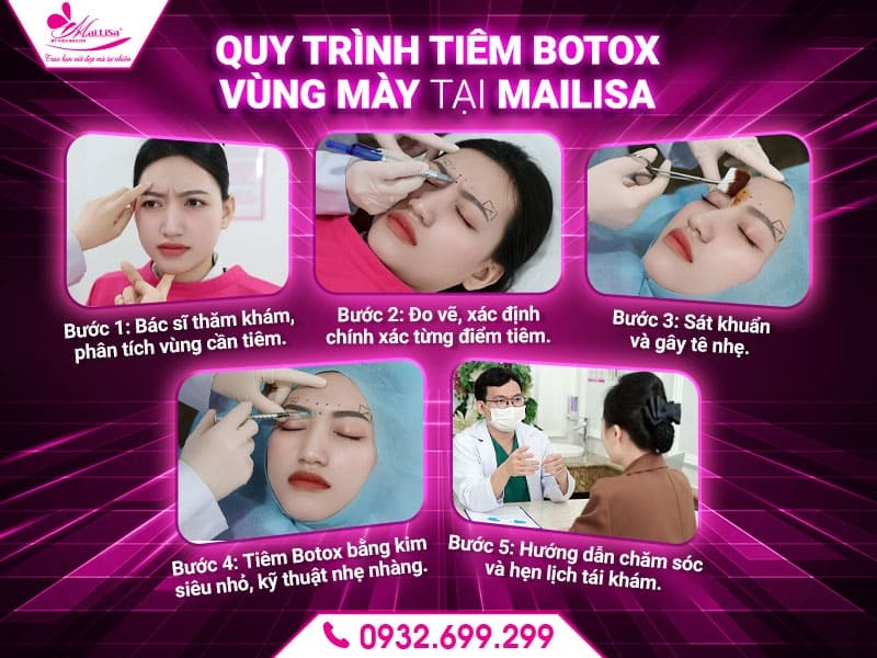 tiem-botox-vung-may-tai-mailisa-co-an-toan-khong