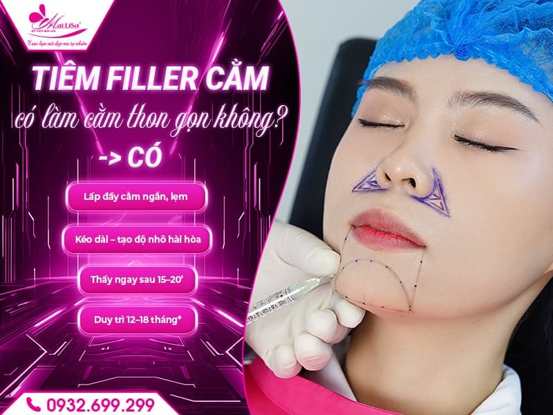 tiem-filler-cam-co-lam-cam-thon-gon-khong