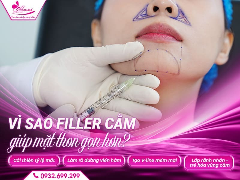 tiem-filler-cam-co-lam-cam-thon-gon-khong