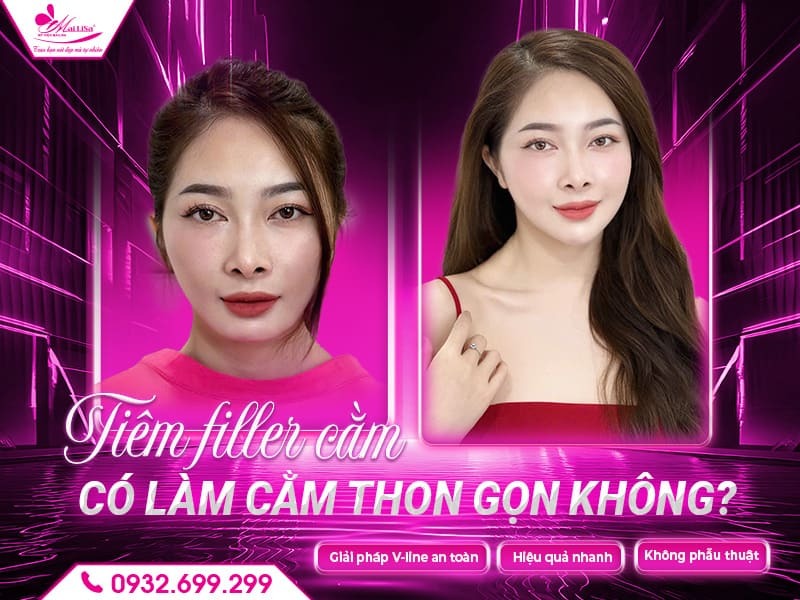 tiem-filler-cam-co-lam-cam-thon-gon-khong