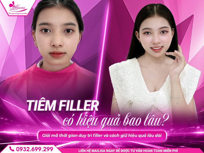 tiem-filler-co-hieu-qua-bao-lau