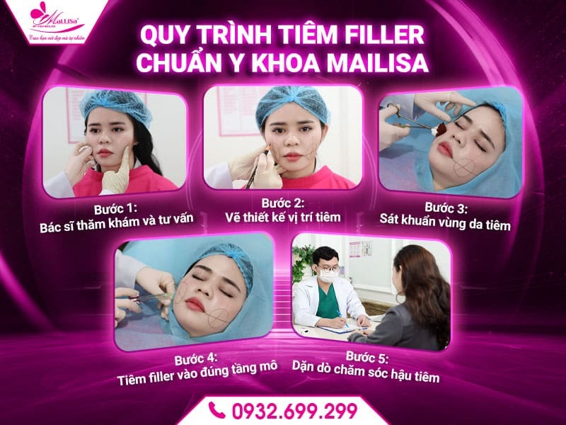 tiem-filler-giup-mat-can-doi-hon