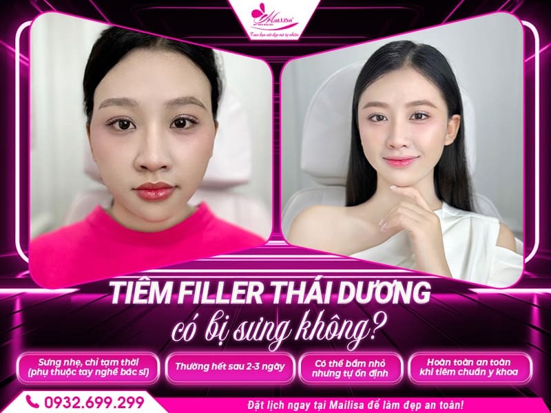 tiem-filler-thai-duong-co-bi-sung-khong