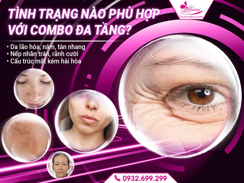 tinh-trang-nao-phu-hop-voi-combo-da-tang