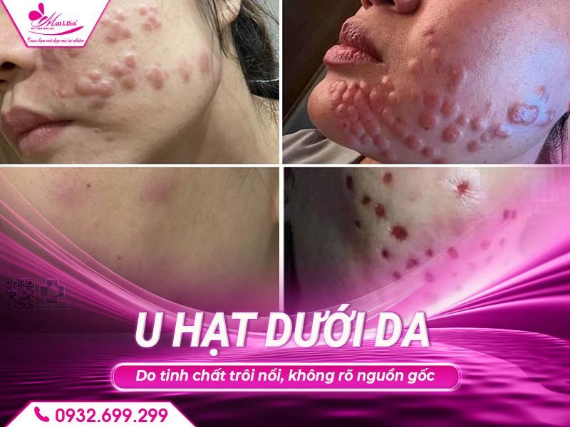 u-hat-duoi-da