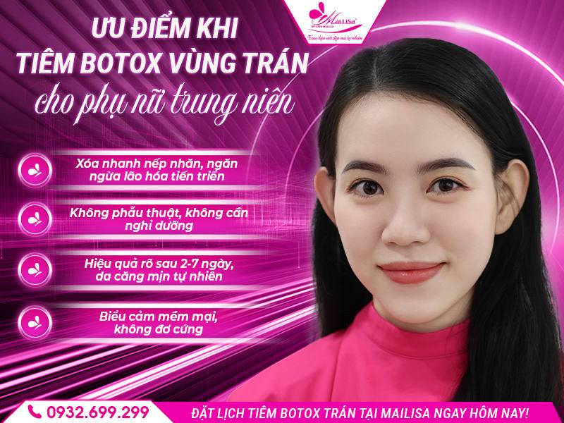 uu-diem-khi-tiem-botox-vung-tran-cho-phu-nu-trung-nien
