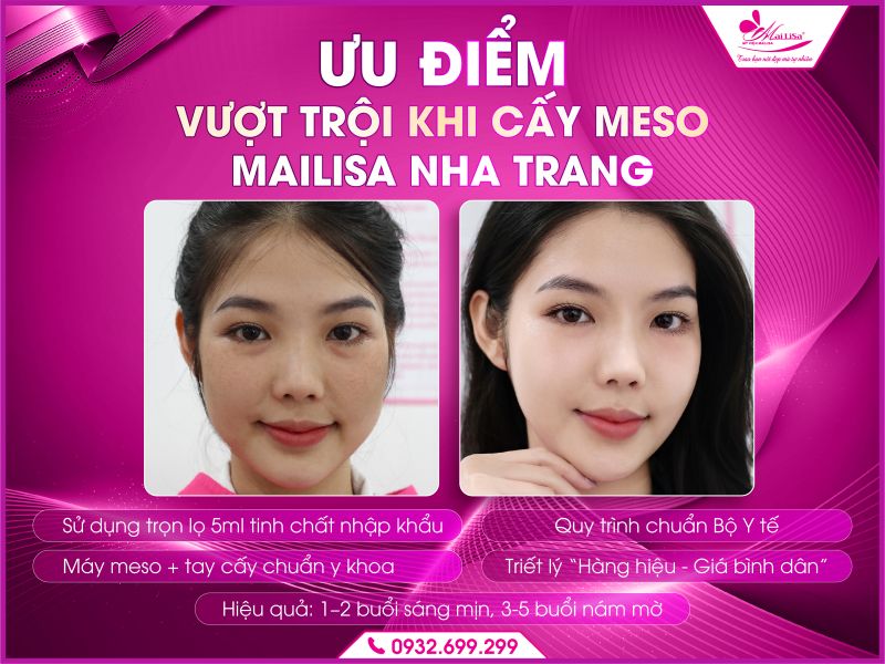 uu-diem-vuot-troi-khi-cay-meso-mailisa-nha-trang