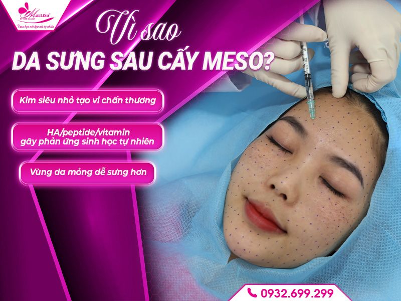 vi-sao-da-sung-sau-cay-meso