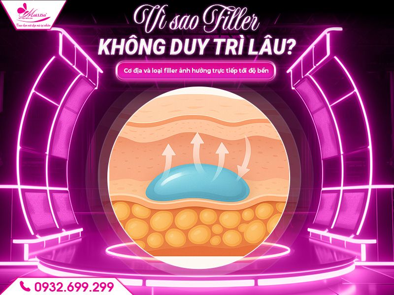 vi-sao-filler-khong-duy-tri-lau