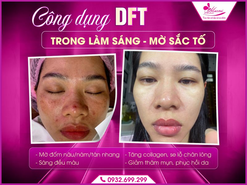 cong-dung-dft-trong-lam-sang-mo-sac-to