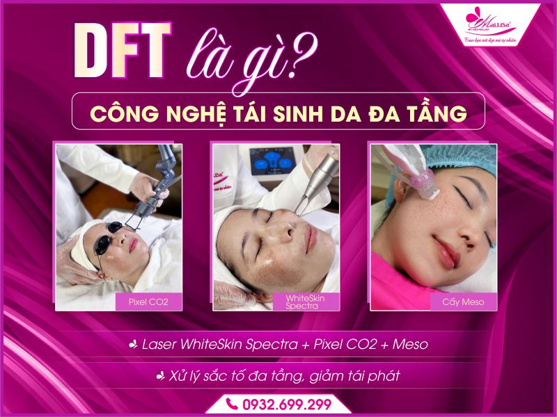 DFT-la-gi-Cong-nghe-tai-sinh-da-da-tang