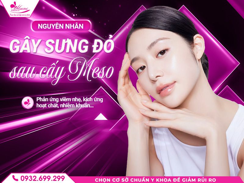 https://mailisa.com nguyen-nhan-gay-sung-do-sau-meso