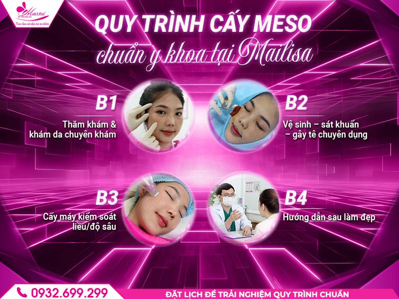 https://mailisa.com quy-trinh-cay-meso-chuan-y-khoa-tai-mailisa