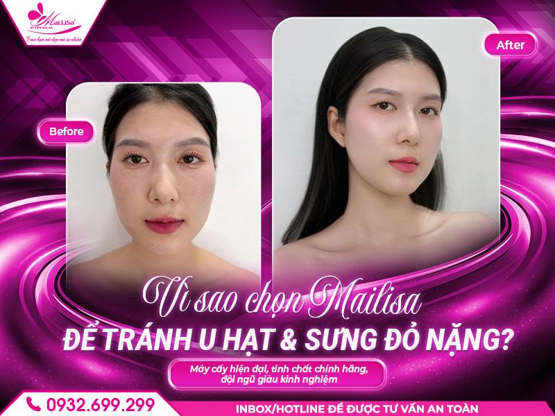 https://mailisa.com vi-sao-chon-mailisa-de-tranh-u-hat-sung-do-nang