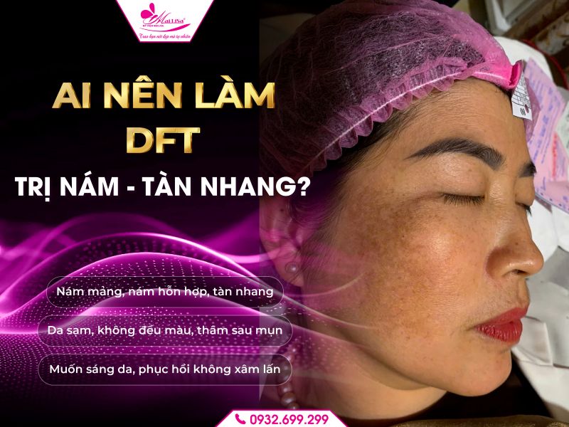 https://mailisa.com ai-nen-lam-dft-tri-nam-tan-nhang