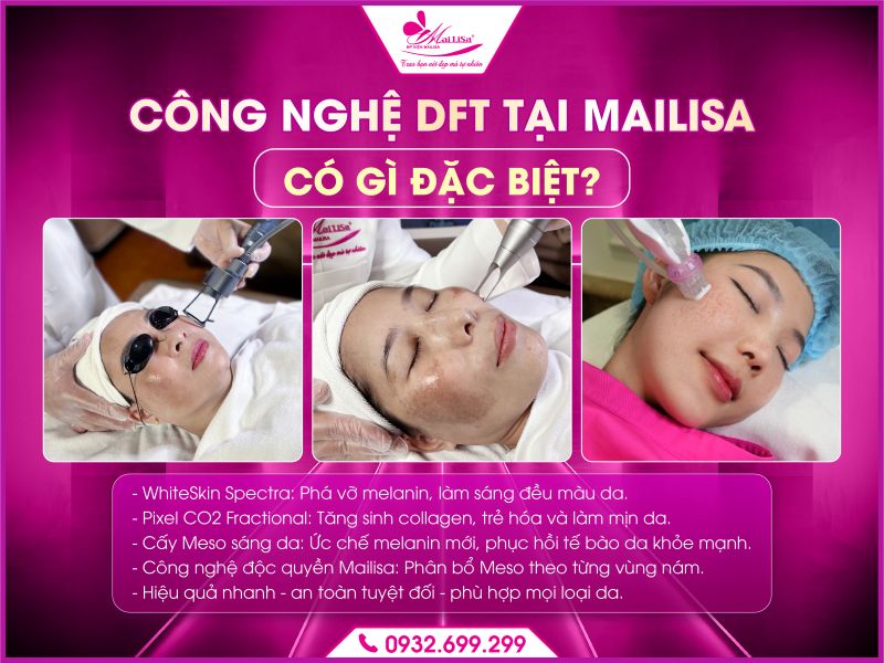 cong-nghe-dft-tai-mailisa-co-gi-dac-biet