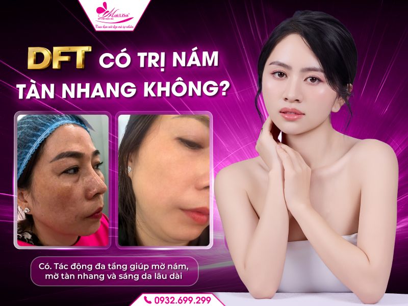 https://mailisa.com dft-co-tri-nam-tan-nhang-khong