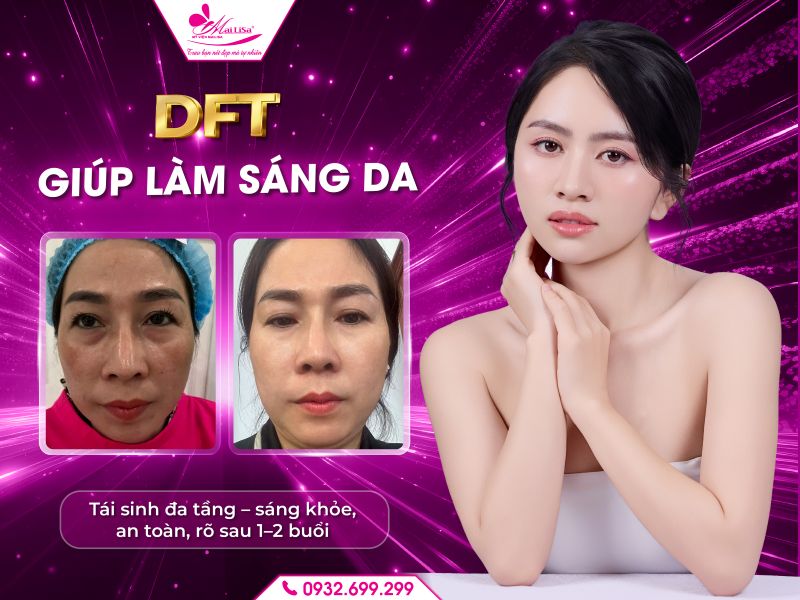 https://mailisa.com dft-giup-lam-sang-da