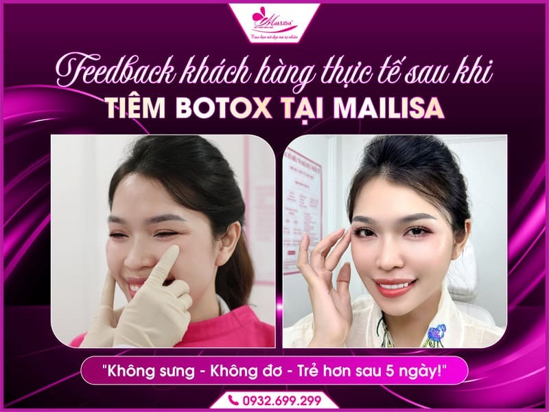 https://mailisa.com gia-tiem-botox-mat-tai-mailisa