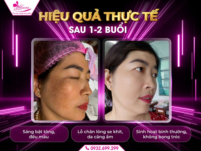 https://mailisa.com hieu-qua-thuc-te-sau-1–2-buoi