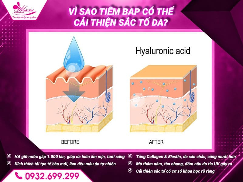 tiem-bap-cai-thien-sac-to-da-khong