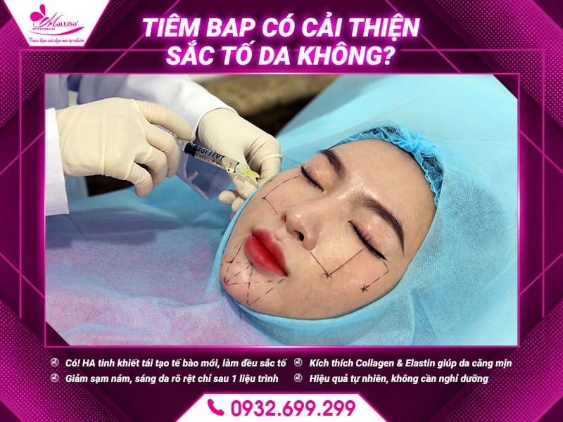 tiem-bap-cai-thien-sac-to-da-khong