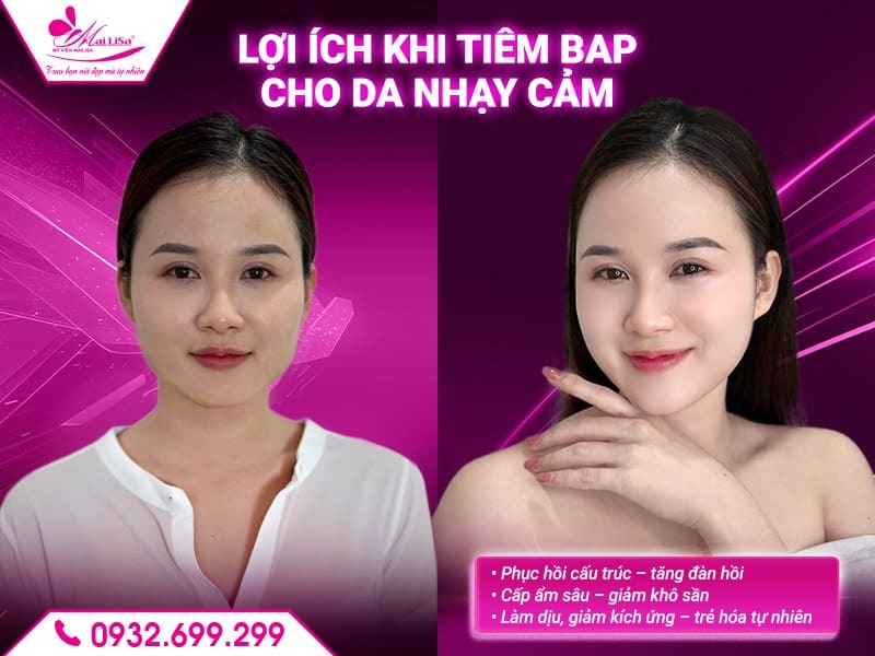 https://mailisa.com tiem-bap-co-phu-hop-cho-da-nhay-cam-khong