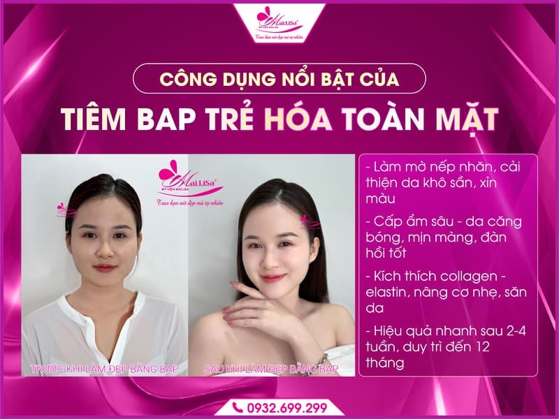 tiem-bap-tre-hoa-toan-mat