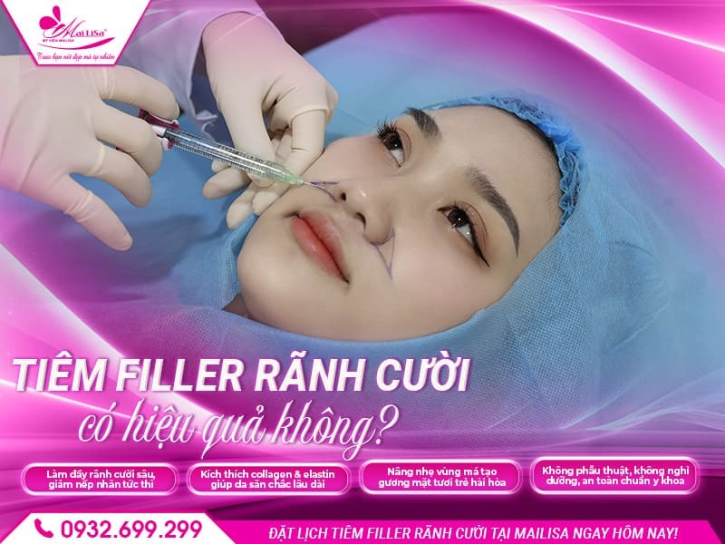 tiem-filler-ranh-cuoi-co-hieu-qua-khong